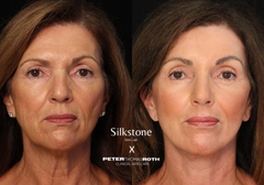 Instant FirmX Face Tightening Cream