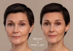 Instant FirmX Face Tightening Cream